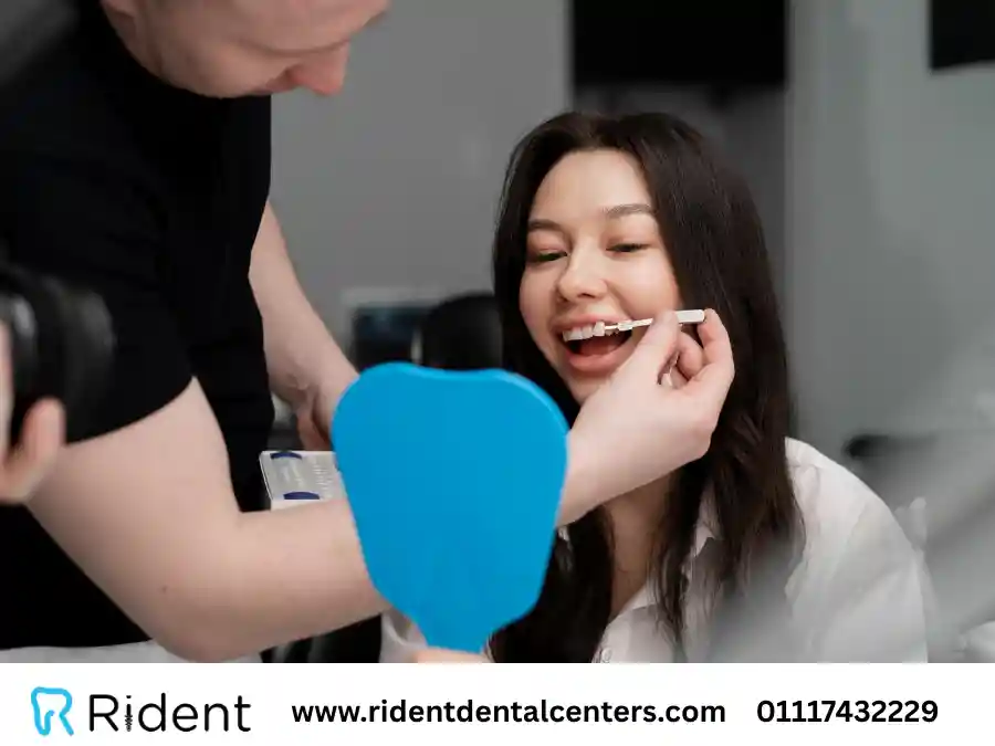 انواع ابتسامة هوليود